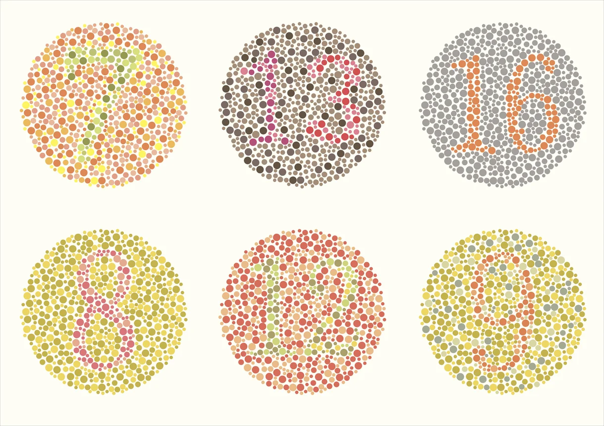 Ishihara K-Means Medical Vision Library